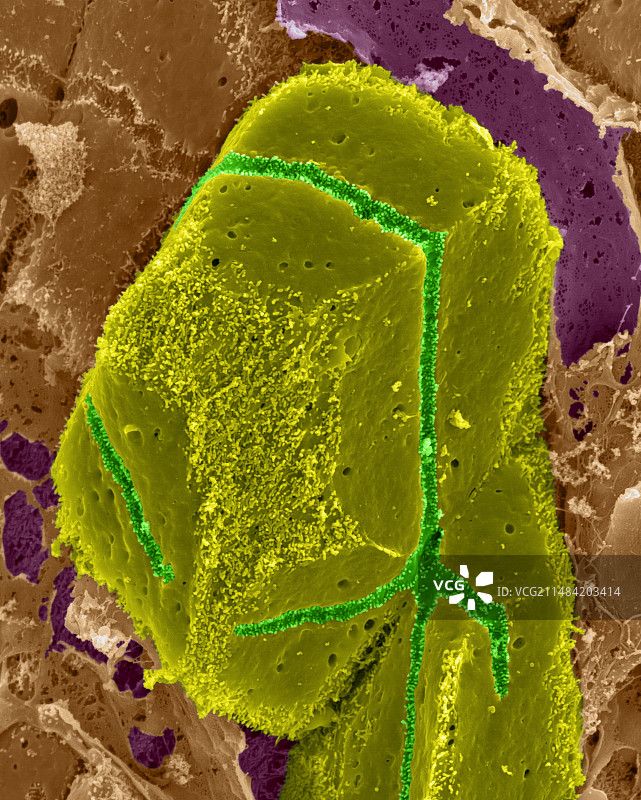 肝脏肝细胞扫描电镜图图片素材
