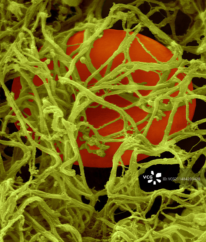 血凝块中的红细胞，SEM图片素材