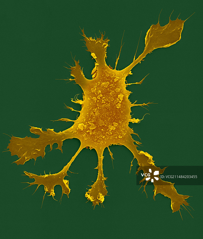 人类树突状细胞，扫描电镜图图片素材