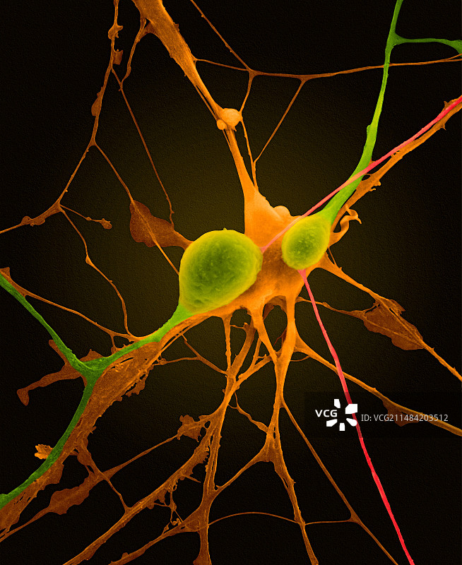 中枢神经系统的锥体神经元，扫描电镜图片素材