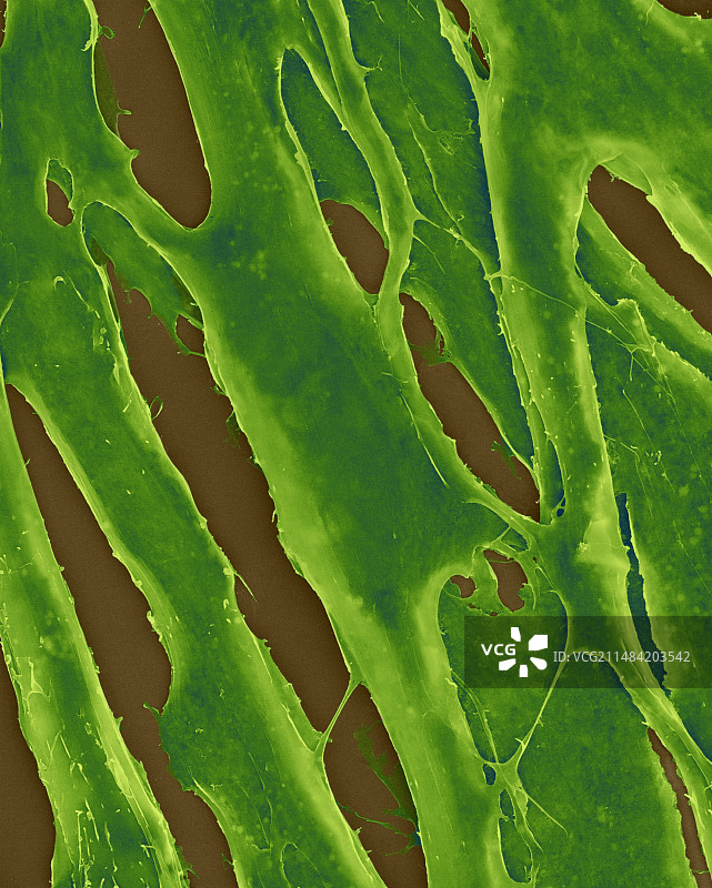 培养皿中的人类纤维原细胞，扫描电子显微镜图片素材