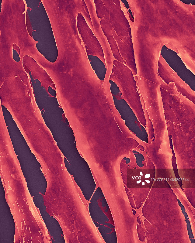 培养皿中的人类纤维原细胞，扫描电子显微镜图片素材