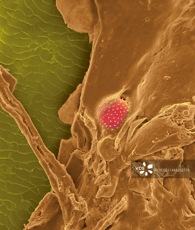 带有粘液和花粉颗粒的鼻毛，扫描电镜图片素材