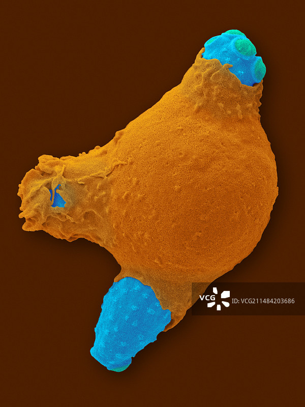 中性粒细胞吞噬念珠菌，扫描电镜图片素材