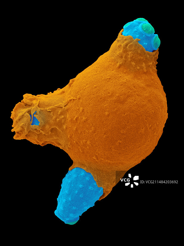 中性粒细胞吞噬念珠菌，扫描电镜图片素材