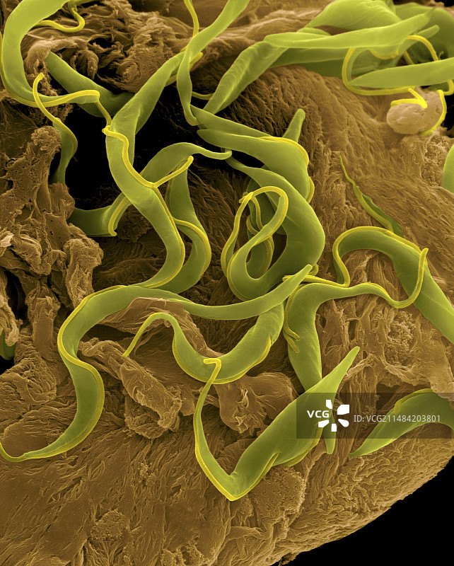 锥虫鞭毛体原虫扫描电镜图片素材