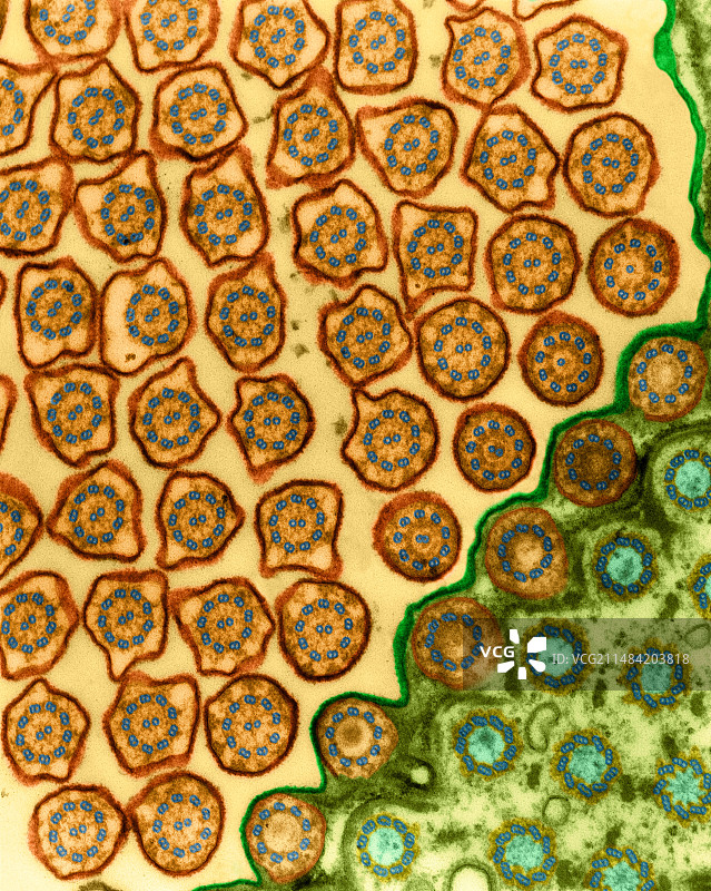 多小核草履虫透射电镜图图片素材