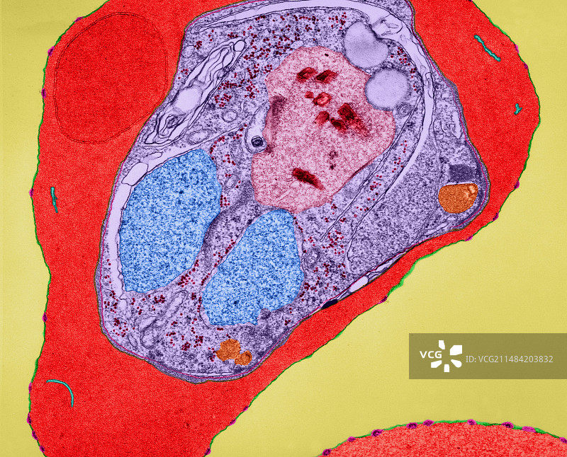 恶性疟原虫（电镜）图片素材