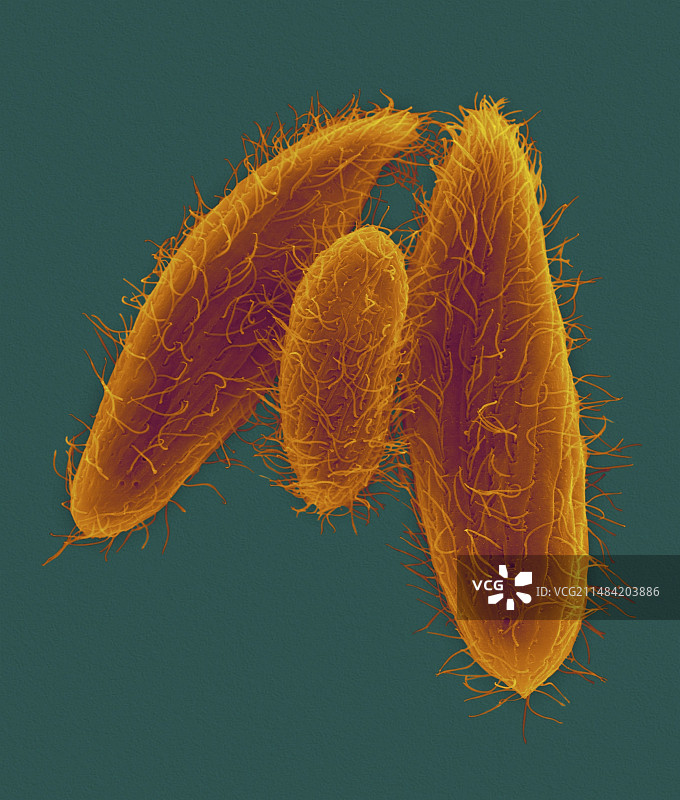 纤毛原生动物（嗜吞四膜虫），扫描电子显微镜图片素材