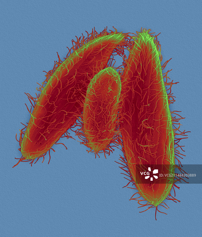 纤毛原生动物（嗜吞四膜虫），扫描电子显微镜图片素材