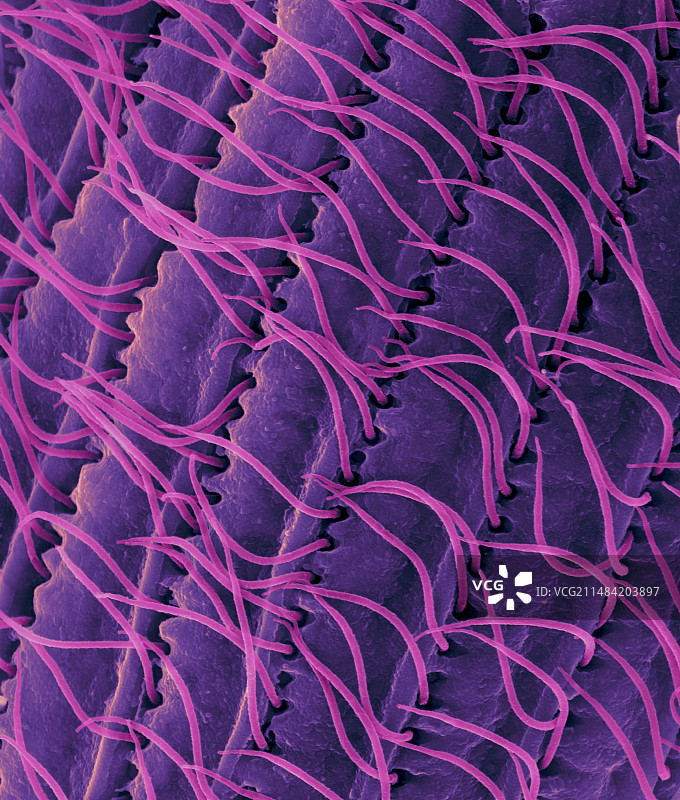 纤毛原生动物（嗜吞四膜虫），扫描电子显微镜图片素材