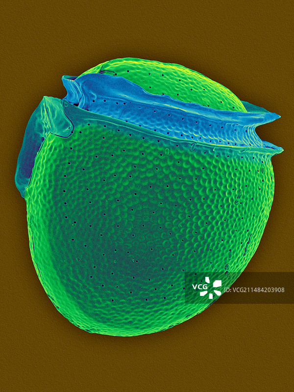 圆形甲藻扫描电镜图图片素材