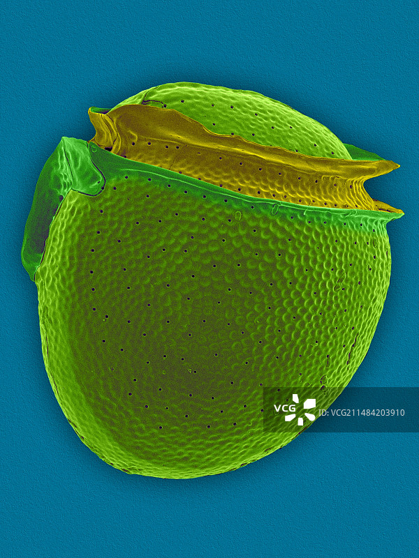 圆形甲藻扫描电镜图图片素材