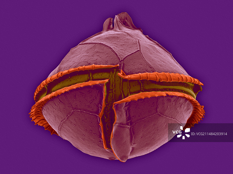 异养甲藻（Oblea sp.），扫描电镜图图片素材