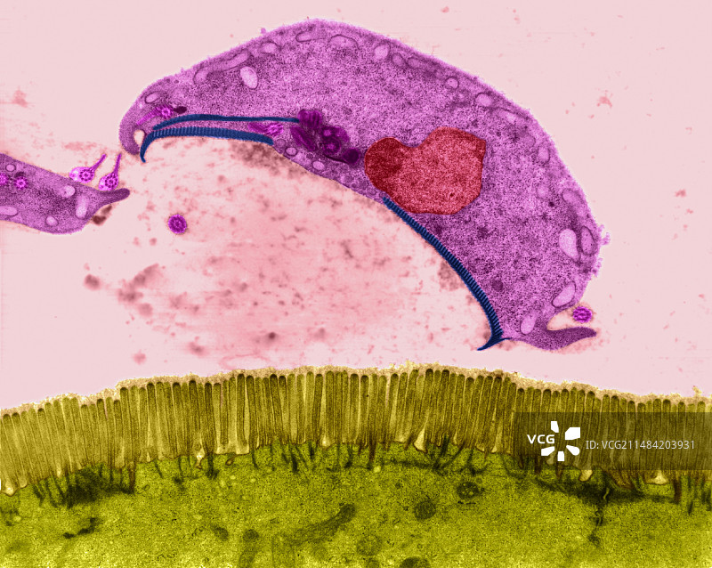 原生动物肠道感染（贾第鞭毛虫属），TEM图片素材