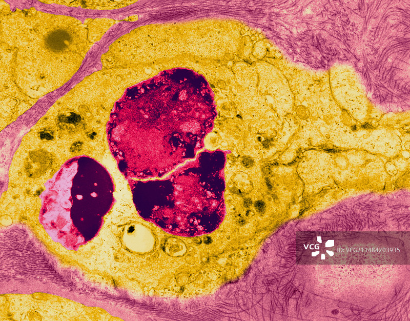 小隐孢子虫肠道感染图片素材