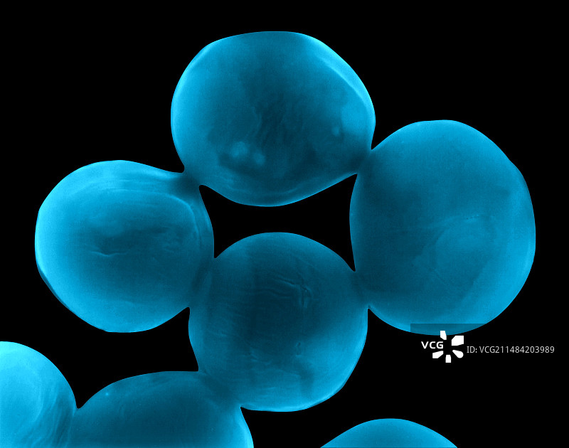 小隐孢子虫原生动物扫描电镜图图片素材