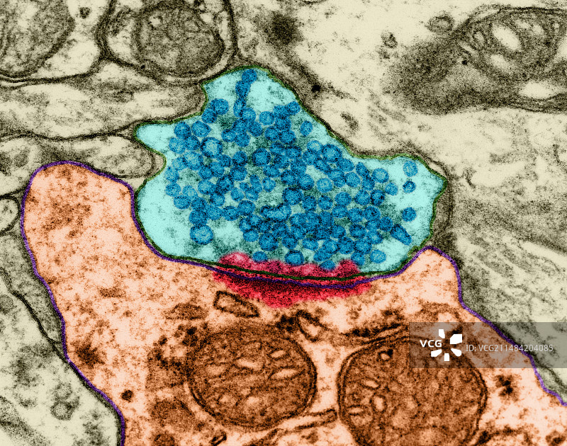 兴奋性突触，TEM图片素材