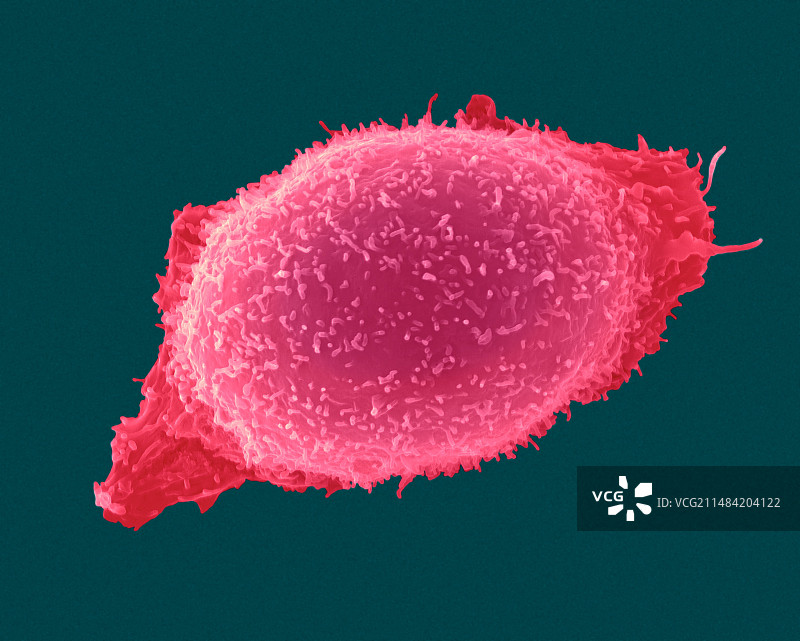 肥大细胞扫描电镜图图片素材