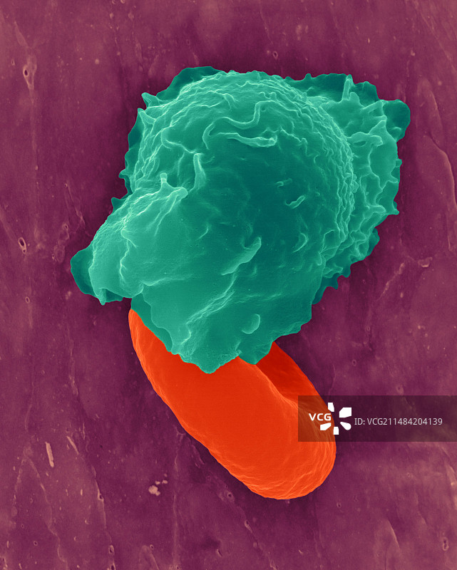 单核细胞吞噬红细胞扫描电镜图图片素材