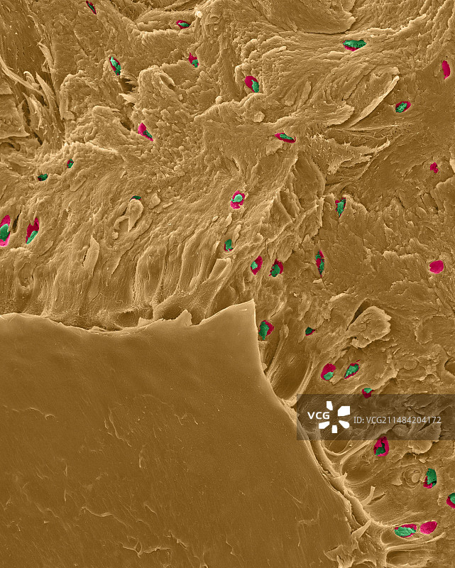 骨折的致密骨中的骨细胞，扫描电镜图片素材