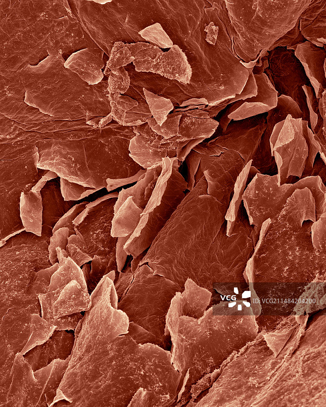 人体皮肤表皮，扫描电镜图片素材