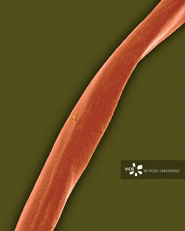 人类阴毛扫描电镜图图片素材