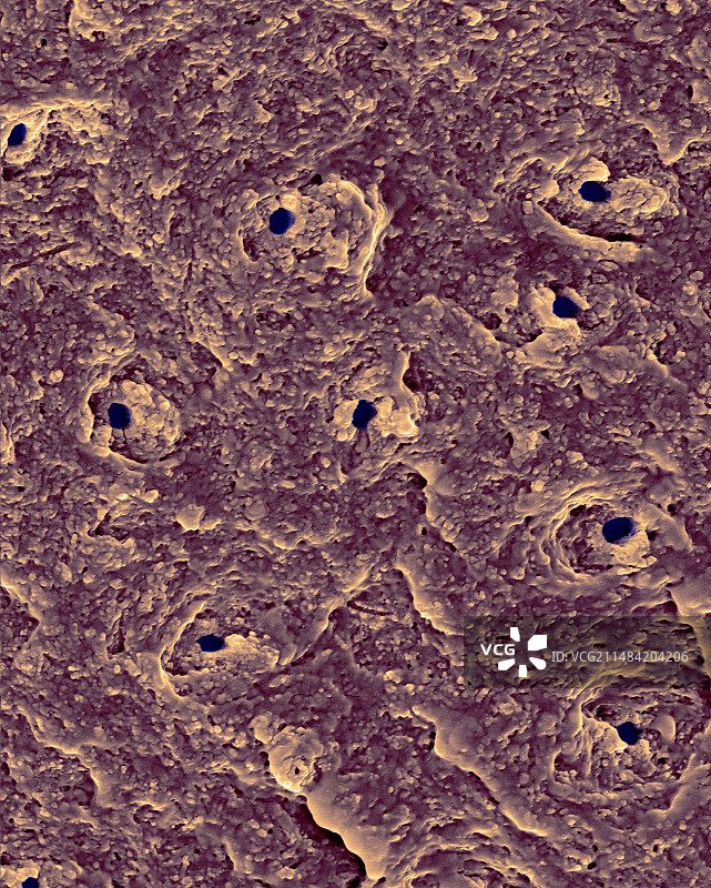 牙齿牙本质区域扫描电镜图图片素材