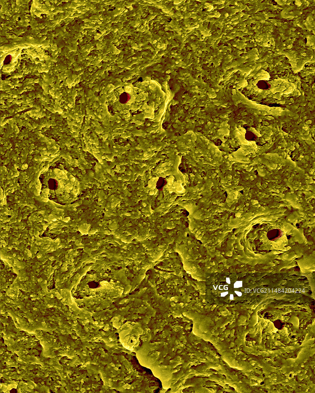 牙齿牙本质区域扫描电镜图图片素材