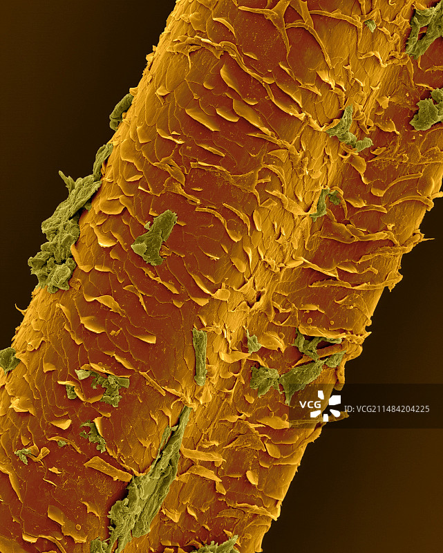 人类睫毛，扫描电镜图片素材