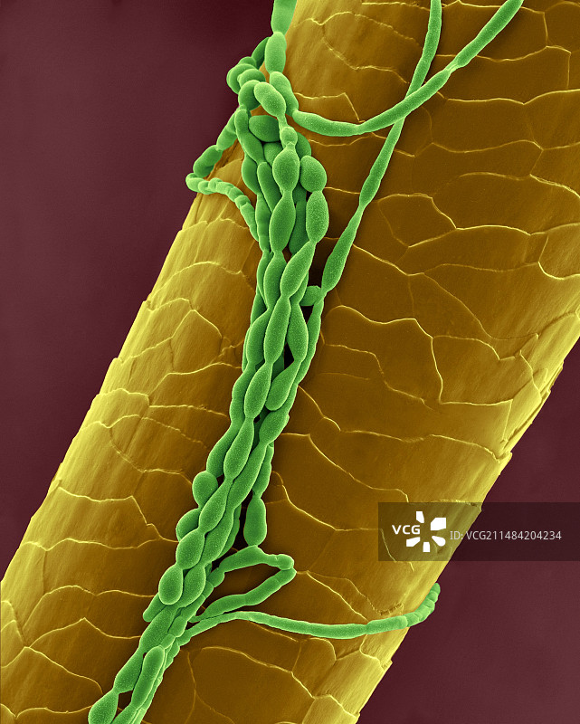 带真菌的人类睫毛扫描电镜图图片素材
