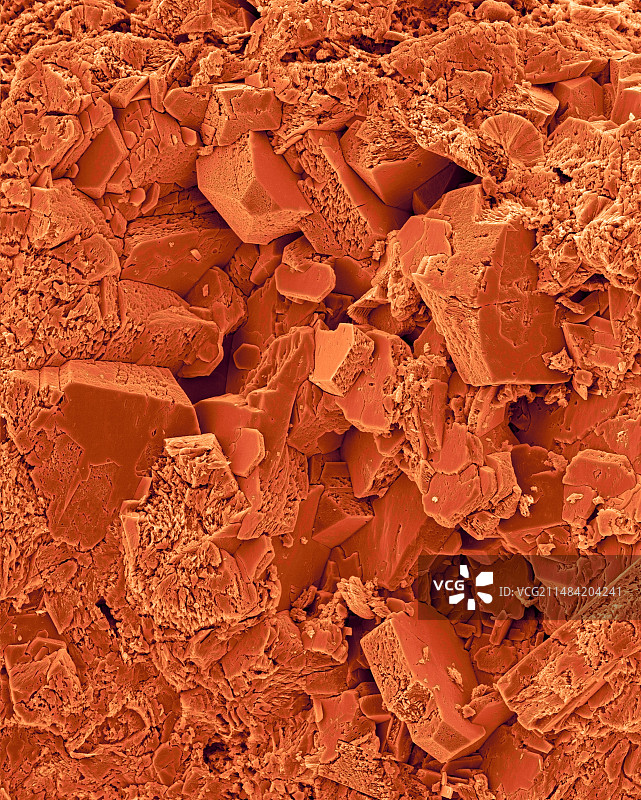 肾结石八面体晶体扫描电镜图图片素材