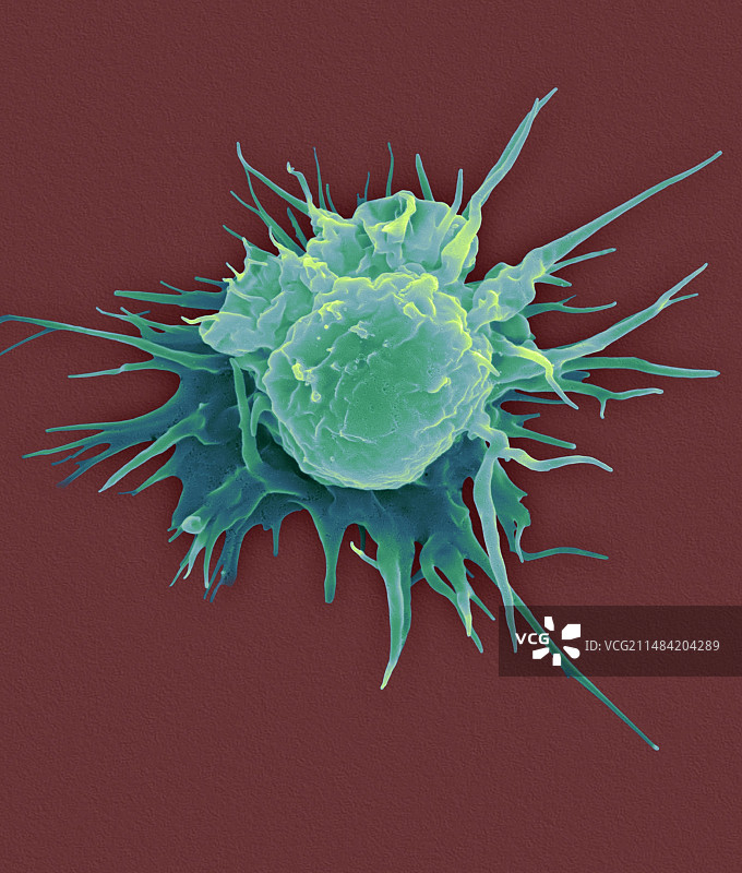 肺泡组织巨噬细胞扫描电镜图图片素材