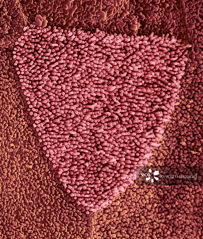 鳞状鼻上皮细胞，扫描电镜图片素材