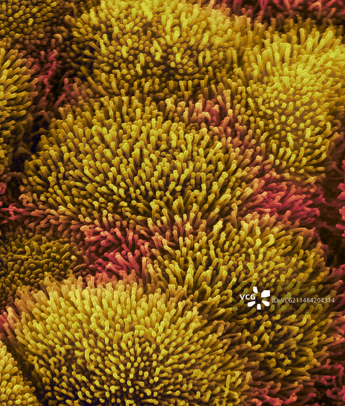 鼻咽上皮细胞与微绒毛扫描电镜图图片素材