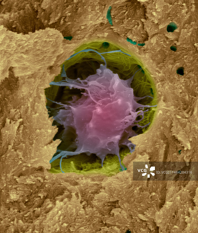 密质骨中的骨细胞扫描电镜图图片素材