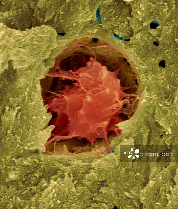 密质骨中的骨细胞扫描电镜图图片素材