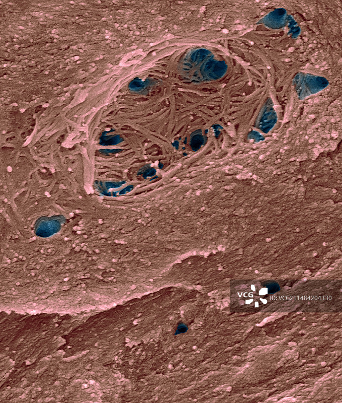 骨陷窝和骨小管扫描电镜图图片素材