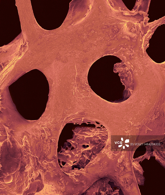 松质骨组织，SEM图片素材