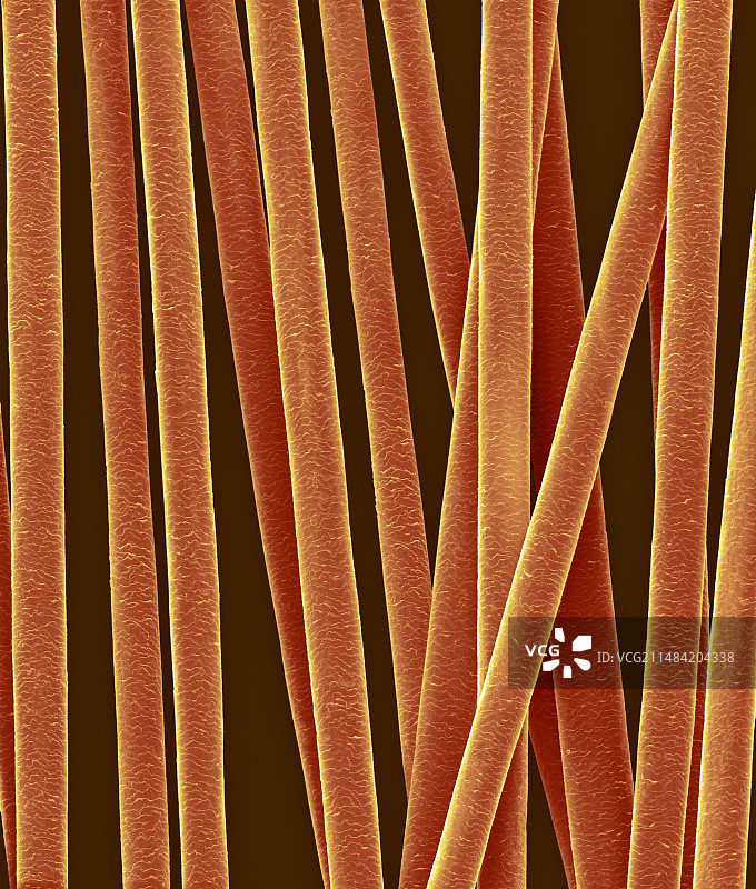 人发毛干扫描电镜图图片素材