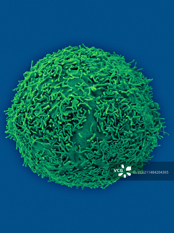 人体淋巴母细胞扫描电镜图图片素材