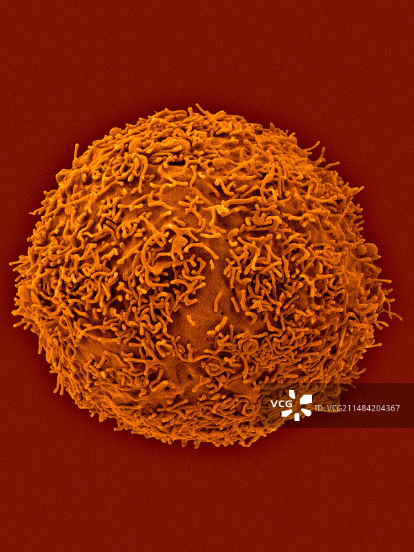 人体淋巴母细胞扫描电镜图图片素材