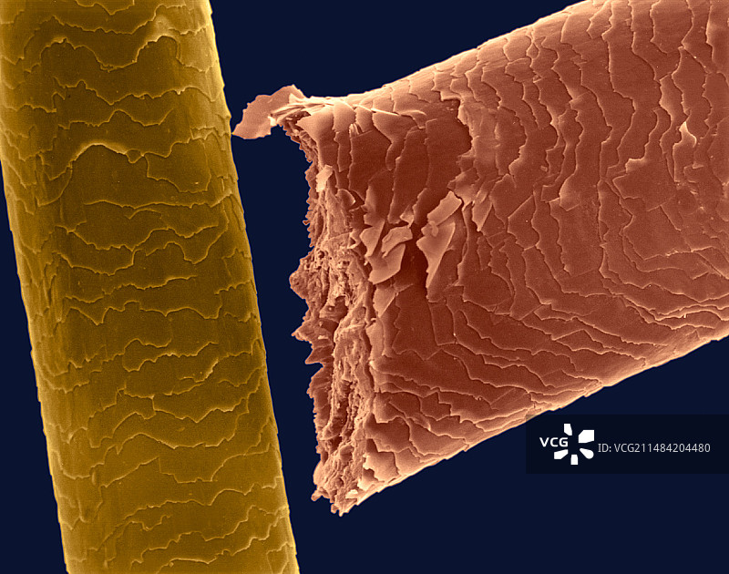 用剪刀剪人类头发的扫描电镜图图片素材