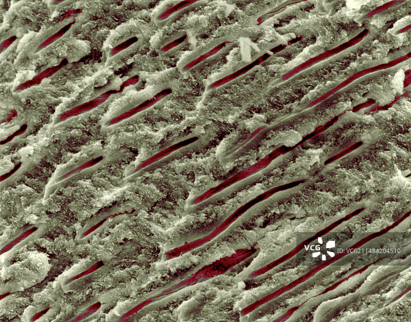 牙齿牙本质区域扫描电镜图图片素材