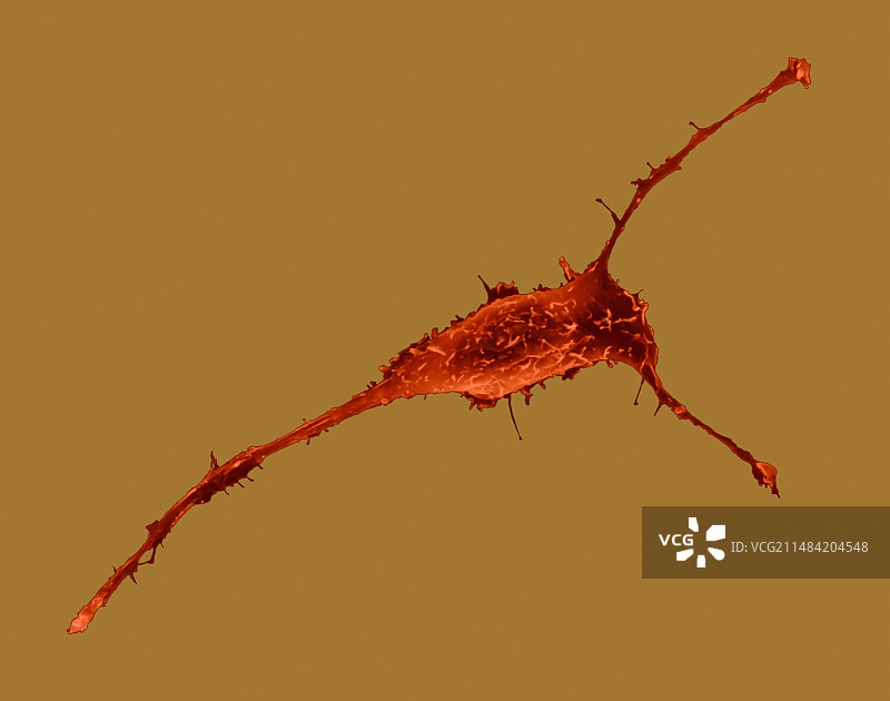 乳腺上皮细胞扫描电镜图图片素材