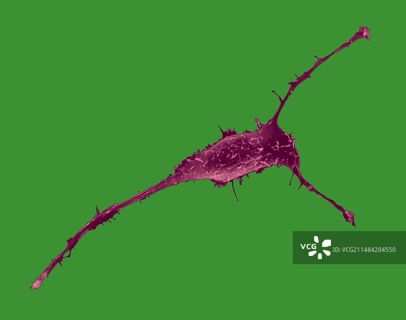 乳腺上皮细胞扫描电镜图图片素材