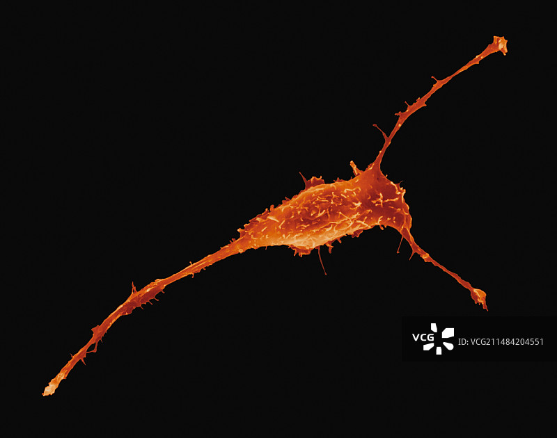 乳腺上皮细胞扫描电镜图图片素材