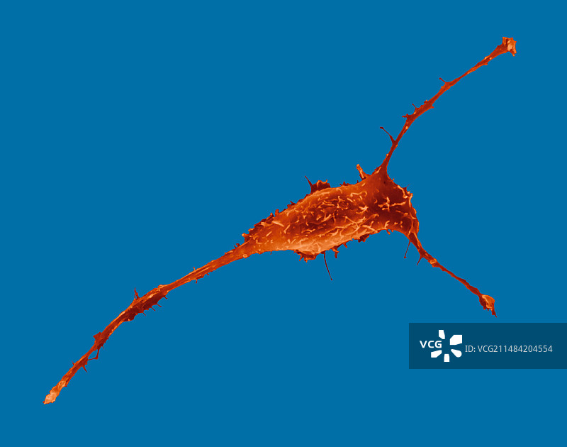 乳腺上皮细胞扫描电镜图图片素材