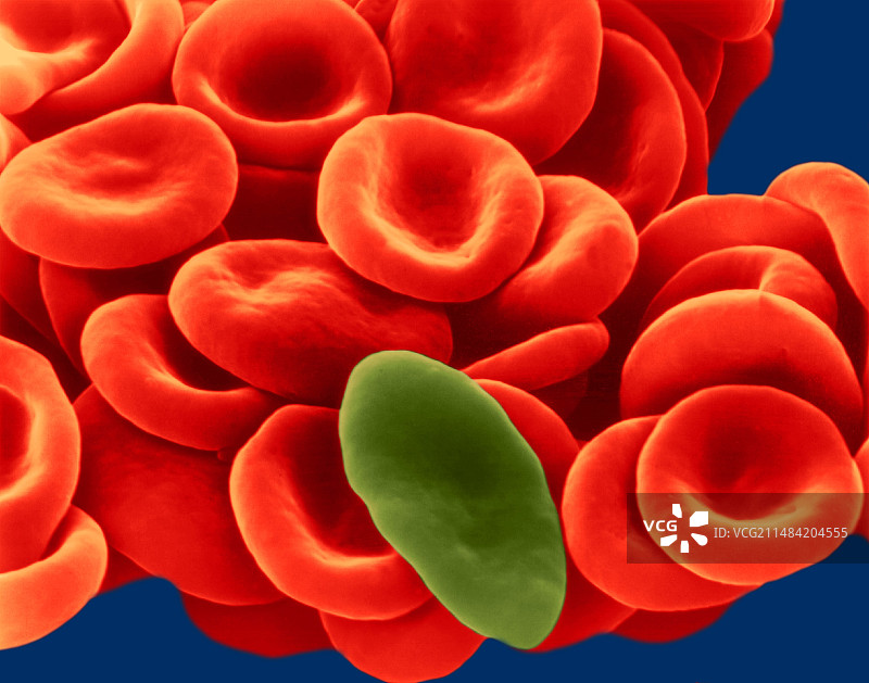 镰状细胞人血电镜扫描图图片素材