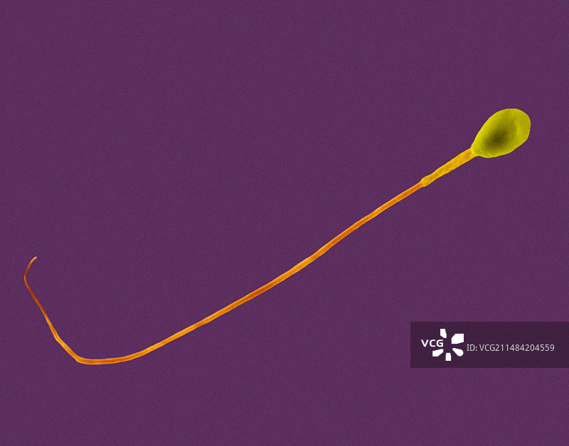 人类精子扫描电镜图图片素材